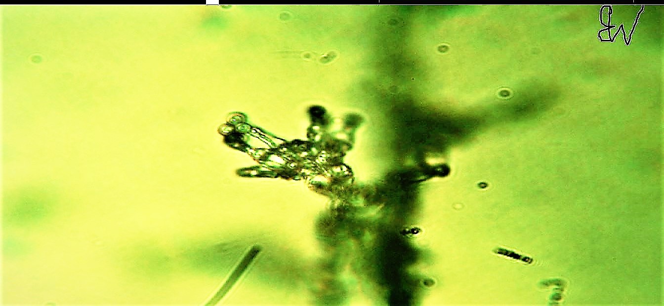 penicillina o aspergillus sp?